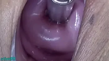 Uncensored Japanese Cervix Stretching and Uterus Dilation with Penetration