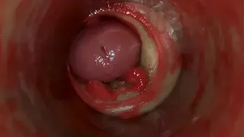 Camera Inside Deep Pussy Captures Huge Ejaculation of Sperm ASMR