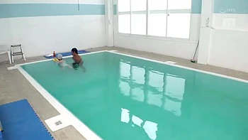 843-youth-with-areare-idv