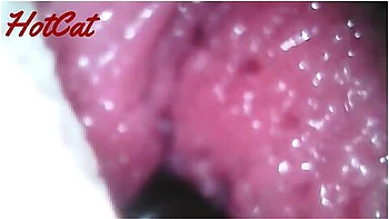 Endoscopic Vaginal Observation