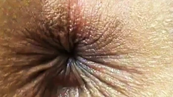 Winking Butthole Close-Up on Webcam