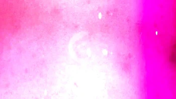 Endearing Goldie at post op xxx